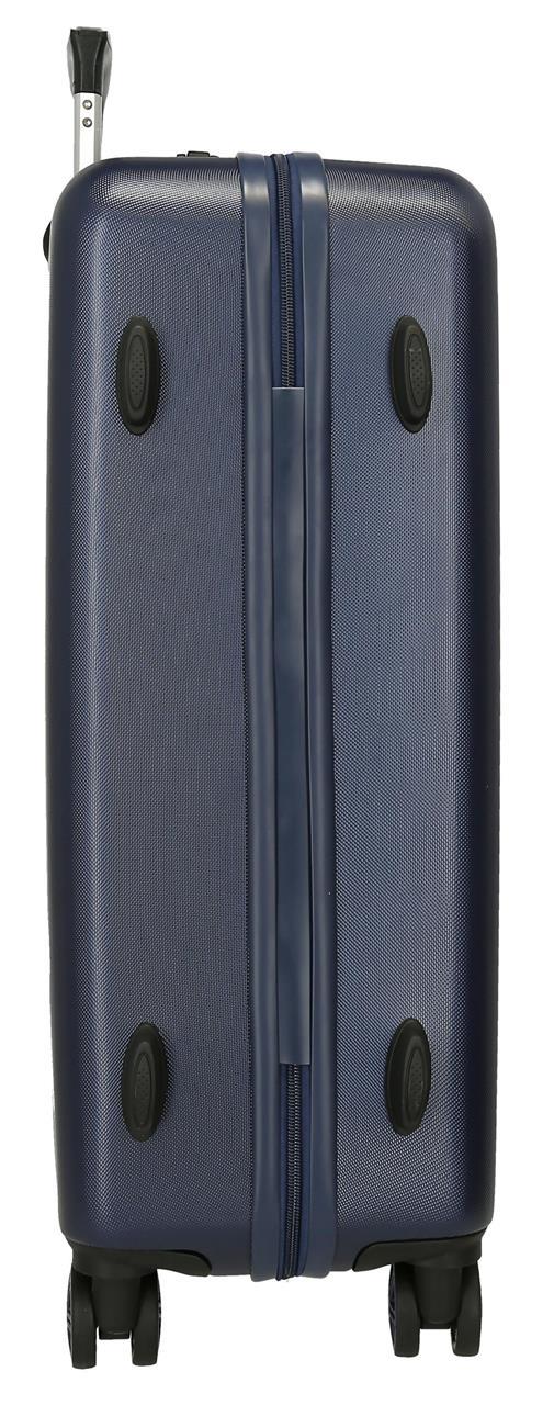 6651421 SET/2 TROLLEY ABS 55-65CM. 4R. PJL TOM